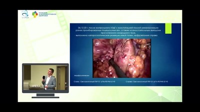 Хохлов М.А. – «Все случайности – не случайны!»